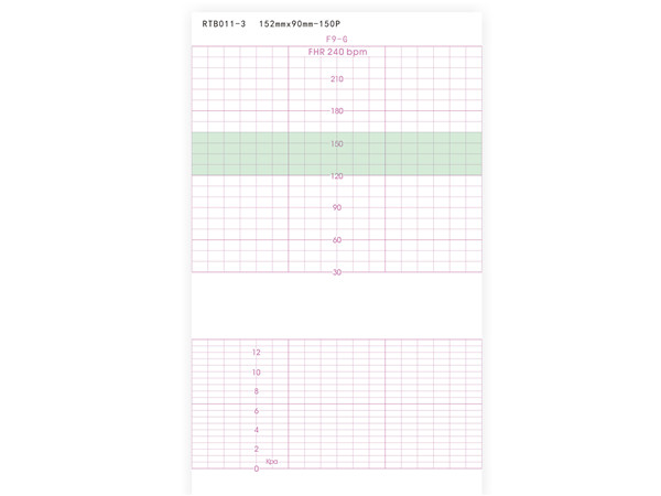 152mmx90mm-150P 胎兒監(jiān)護(hù)
